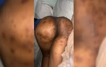 Hannah Yansh Leak Video with craw craw